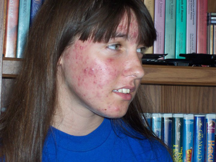 199432_10150112104449514_5933042_n